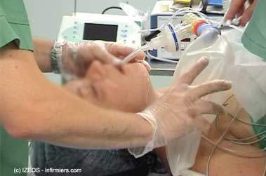 Patient intubé au bloc opératoire (crédits sur la photo).