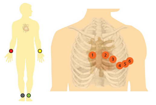 Placement des électrodes pour un ECG 12 dérivations. (https://book.cardio-fr.com/fr/01-notions-elementaires/03-position-electrodes)