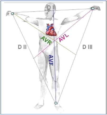 Dérivations frontales sur un ECG.